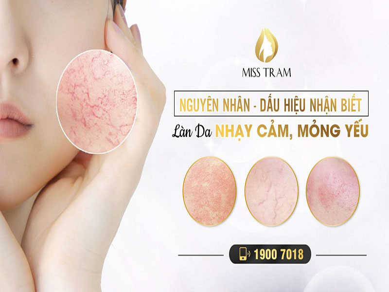 cách phân biệt da nhạy cảm