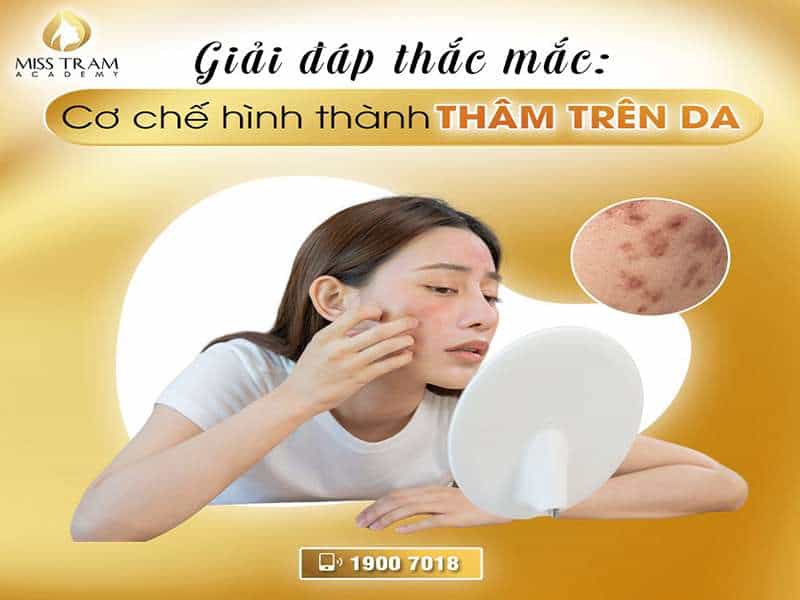 Nguyên Nhân & Cách Khắc Phục Thâm Da 177 Giải Đáp Thắc Mắc Cơ Chế Hình Thành Thâm Da