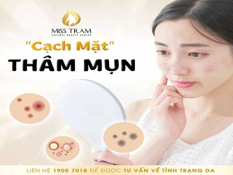 Tạm Biệt Thâm Mụn Cho Làn Da Căng Bóng, Mịn Màng