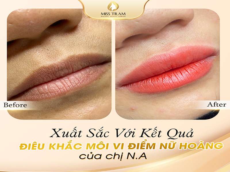 Ngắm Kết Quả Điêu Khắc Môi Vi Điểm Nữ Hoàng Của Chị NaNgắm Kết Quả Điêu Khắc Môi Vi Điểm Nữ Hoàng Của Chị Na