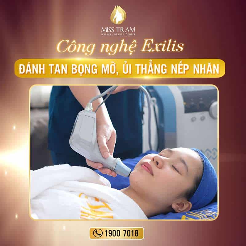 Công nghệ Exilis