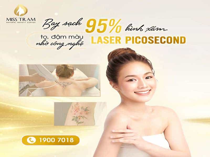 Công Nghệ Laser Picosecond Xóa Xăm Hiệu Quả Đến 95%