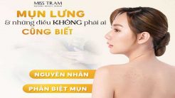 Mụn Lưng: Nguyên Nhân Và Cách Khắc Phục