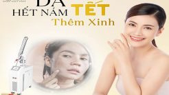 Không Còn Nám Da – Tự Tin Đón Tết