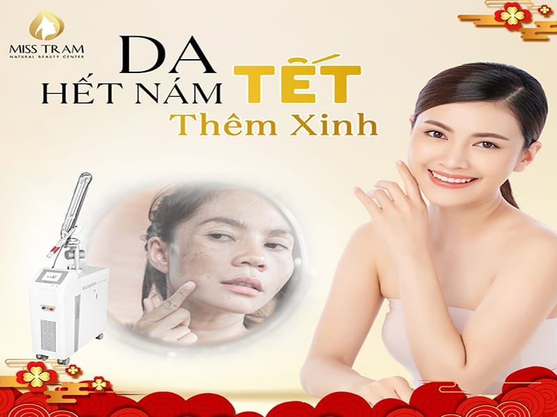 Không Còn Nám Da – Tự Tin Đón Tết
