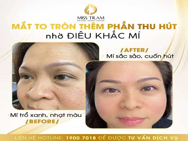 Điêu Khắc Mí Đẹp Tự Nhiên