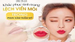 Cách Xử Lý Lệch Viền Môi Đơn Giản, Hiệu Quả