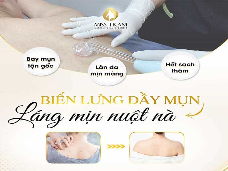 Tuyệt Chiêu Đẩy Lùi Mụn Lưng Cho Da Nuột Nà, Láng Mịn