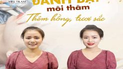 Đánh Bật Môi Thâm – Thêm Hồng, Tươi Sắc