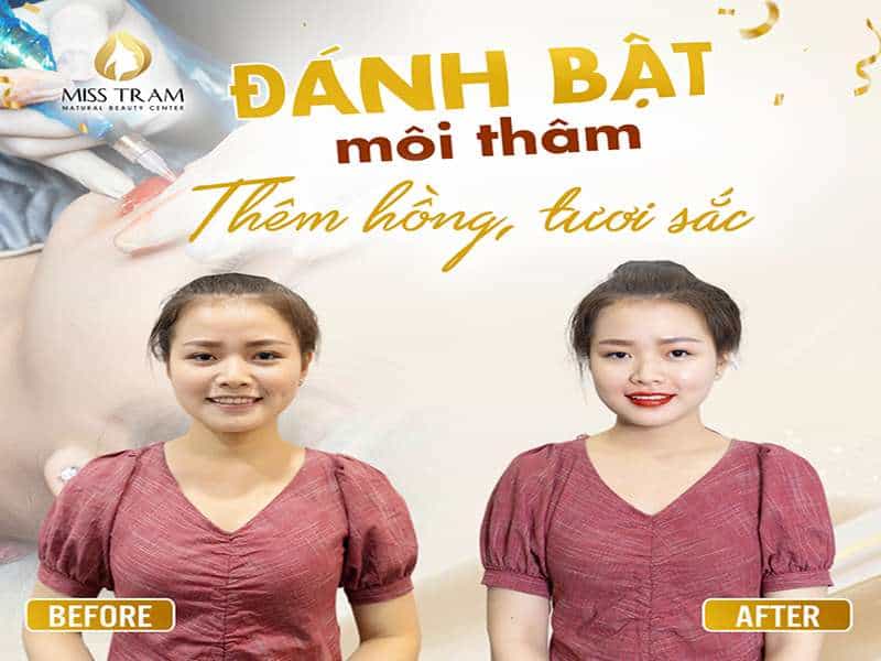 Đánh Bật Môi Thâm – Thêm Hồng, Tươi Sắc