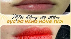 Môi Hồng Đỏ Thắm, Rực Rỡ Nắng Hồng Tươi