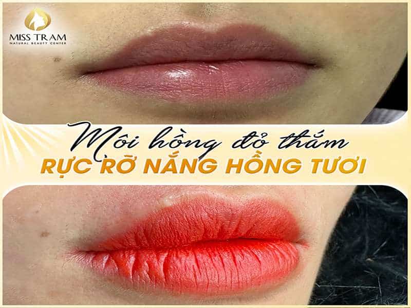 Môi Hồng Đỏ Thắm, Rực Rỡ Nắng Hồng Tươi