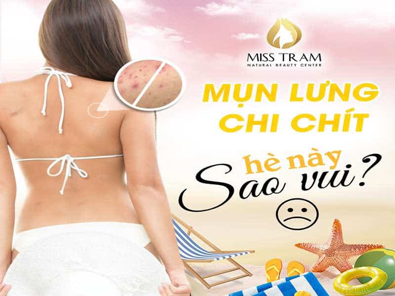 Mụn Lưng Chi Chít – Hè Này Sao Vui?