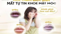 Môi Thâm Bẩm Sinh Khiến Bạn Mất Tự Tin Khoe Mặt Mộc?