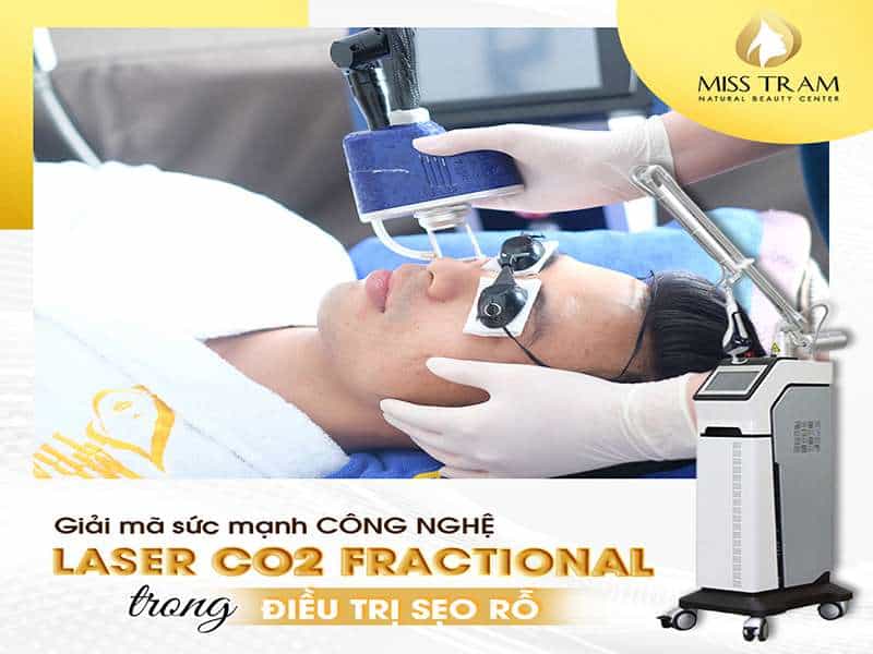 Giải Mã Sức Mạnh Công Nghệ Laser CO2 Fractional Trong Trị Sẹo Rỗ