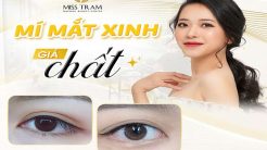 Mí Mắt Xinh – Giá “Chất” – Duy Nhất Tại Miss Tram Spa