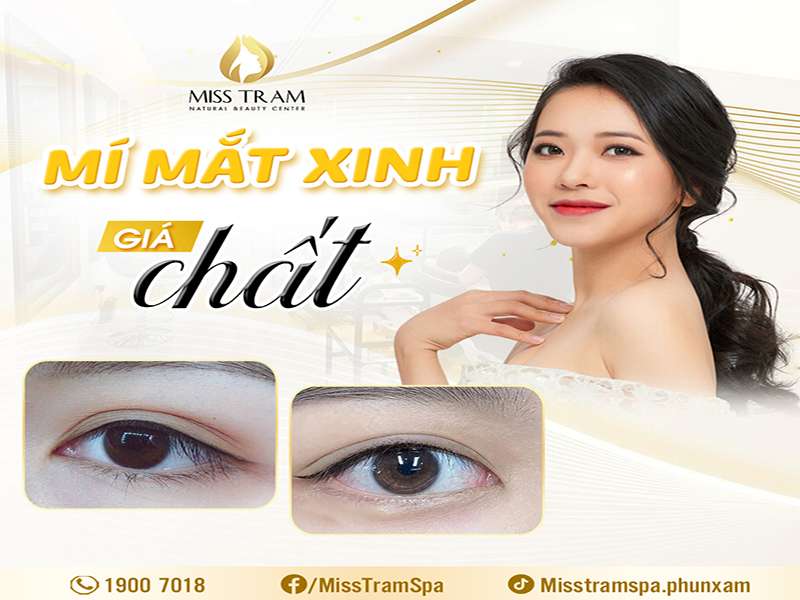 Mí Mắt Xinh – Giá “Chất” – Duy Nhất Tại Miss Tram Spa