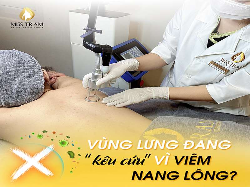 Vùng Lưng Đang “Kêu Cứu” Vì Viêm Nang Lông?