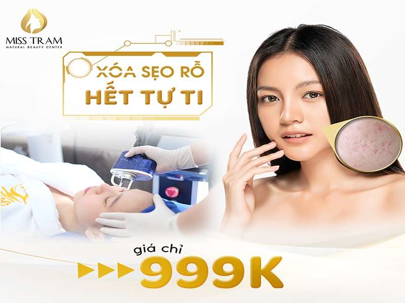 Xóa Sẹo Rỗ – Hết Tự Ti: Chỉ 999K