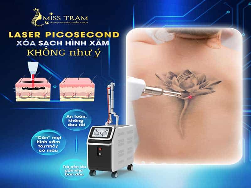 LASER PICOSECOND – Xóa Sạch Mọi Dấu Tích Hình Xăm Không Như Ý