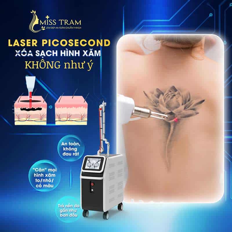 Laser PicoSecond – Công Nghệ Xóa Hình Xăm An Toàn 