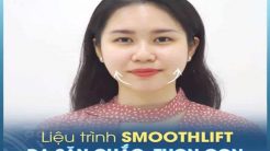 Chỉ 1 Liệu Trình SMOOTHLIFT – Da Săn Chắc, Thon Gọn Chuẩn Vline