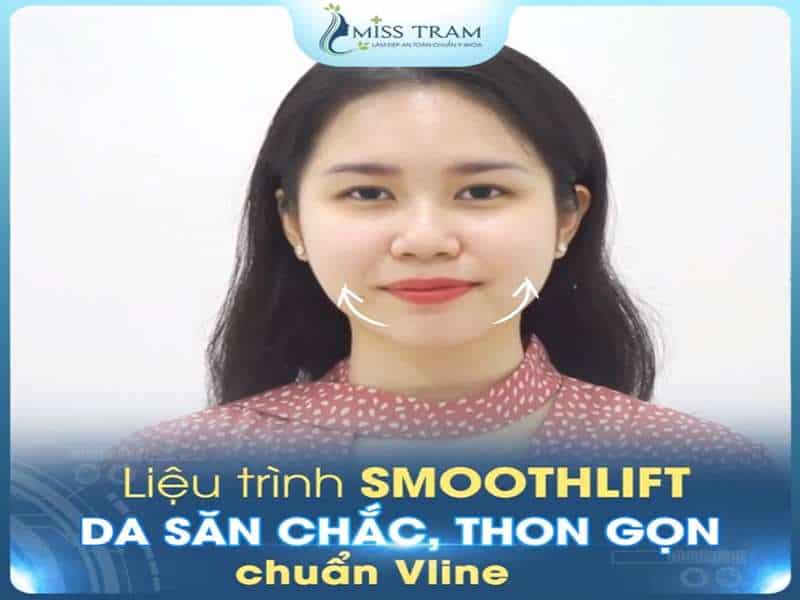 Chỉ 1 Liệu Trình SMOOTHLIFT – Da Săn Chắc, Thon Gọn Chuẩn Vline