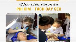 Đã Đến Giờ Thực Hành Phi Kim, Tách Đáy Sẹo