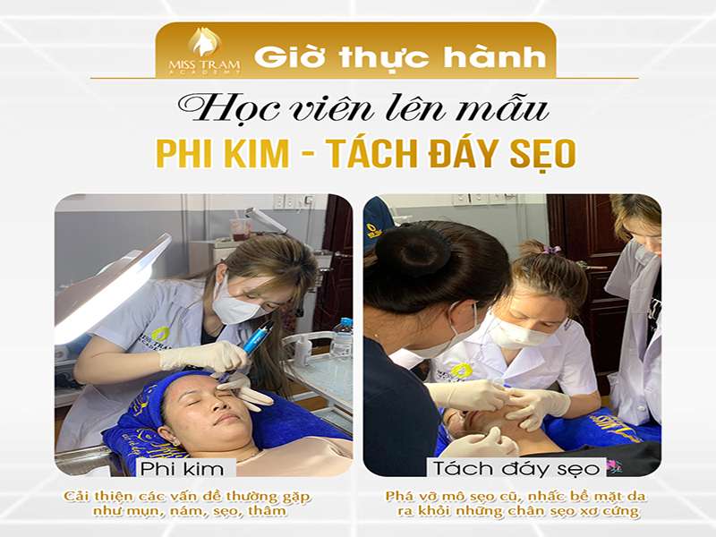 Đã Đến Giờ Thực Hành Phi Kim, Tách Đáy Sẹo