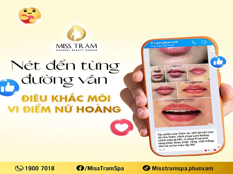 Đôi Môi Căng Mọng, Quyến Rũ – Chỉ Sau 60 Phút