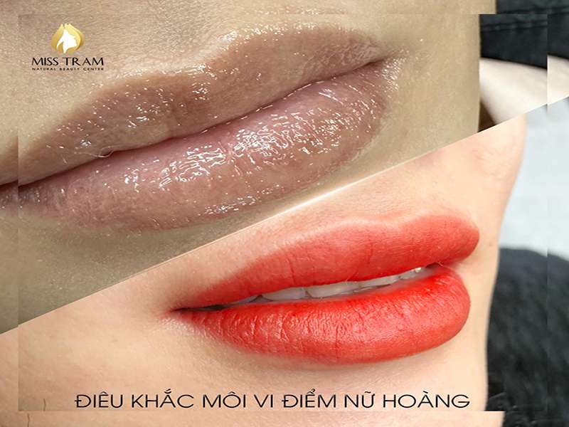 Môi Thâm “Hóa Phép” Vạn Người Mê Chỉ Với 60 Phút