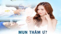 Miss Tram - Địa chỉ tin cậy cho vấn đề mụn thâm