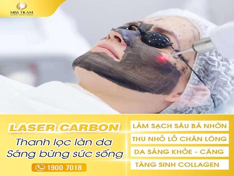 Laser Carbon: Thanh Lọc Làn Da, Sáng Bừng Sức Sống