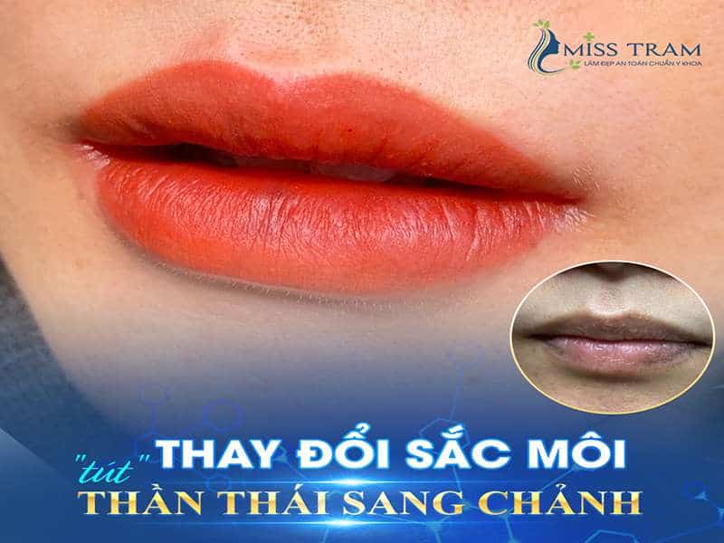 Thay đổi sắc môi - Cách giúp bạn tự tin và sang chảnh hơn