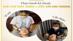 Thực Hành Kỹ Thuật Thải Chì Thủy Ngân + Cấy Chỉ Kim Cương