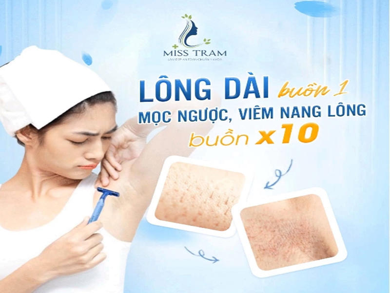 Lông Dài Buồn 1 Mọc Ngược, Viêm Nang Lông Buồn X100