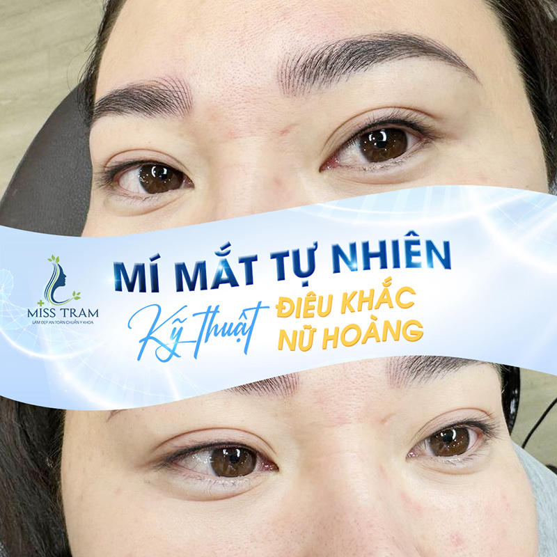 Chiêm Ngưỡng Kết Quả Điêu Khắc Mí Mắt Nữ Hoàng
