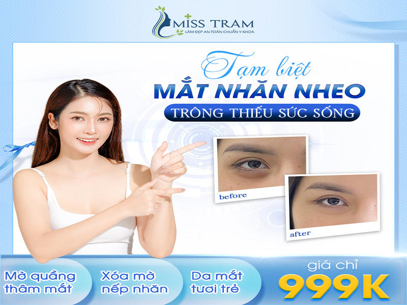 Tạm Biệt Mắt Nhăn Nheo Trông Thiếu Sức Sống