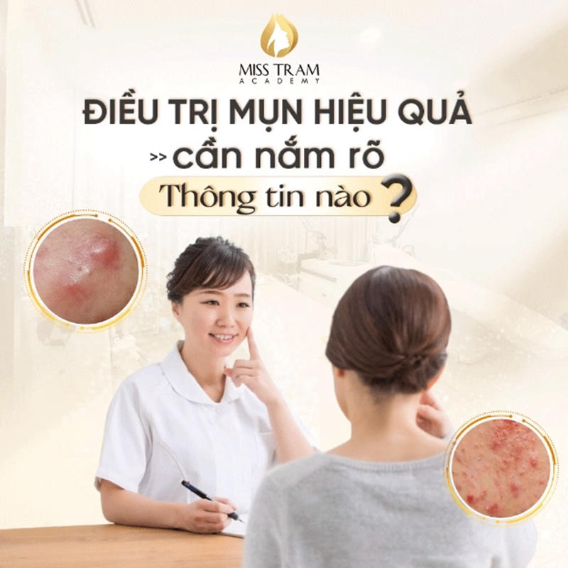 Điều Trị Mụn Hiệu Quả Cần Nắm Rõ Những Thông Tin Nào
