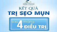 Kết Quả Trị Sẹo Mụn Sau 4 Tháng