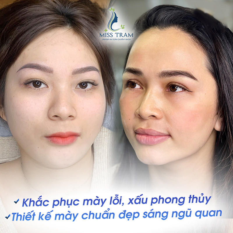 Khắc phục mày lỗi