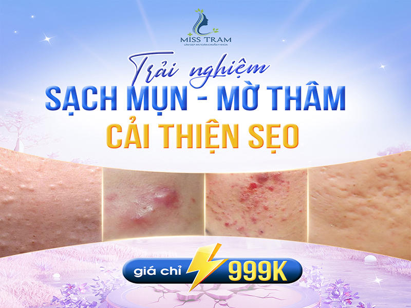 Bí Quyết Cho Da Hoàn Hảo: Sạch Mụn, Mờ Thâm