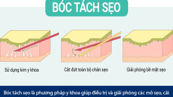 boc tach seo